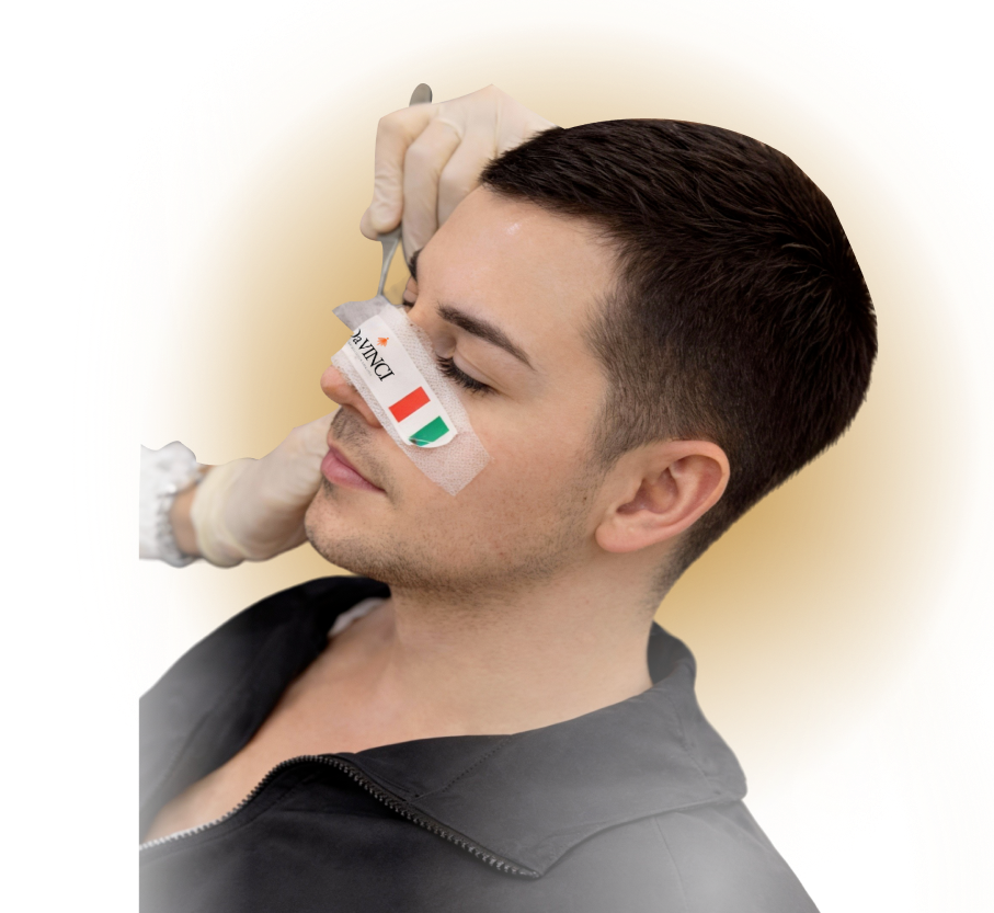 Rinoplastica Tecniche